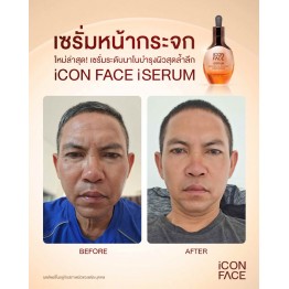 Review - รีวิว iCon Face iSerum